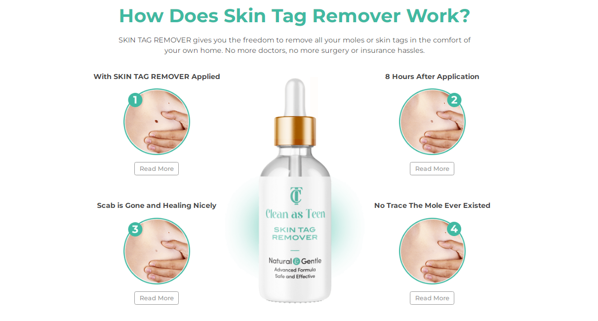 Clean as Teen Skin Tag Remover